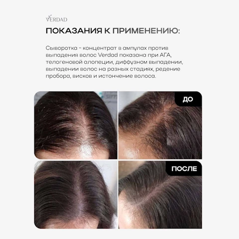 Сыворотка-концентрат от выпадения с Capixyl, розмарином, цинком, медью, Verdad