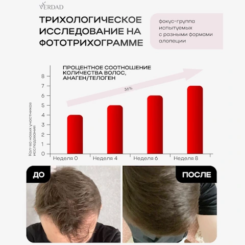 Сыворотка-концентрат от выпадения с Capixyl, розмарином, цинком, медью, Verdad