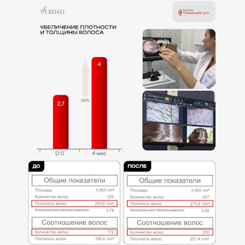 Сыворотка-концентрат от выпадения с Capixyl, розмарином, цинком, медью, Verdad