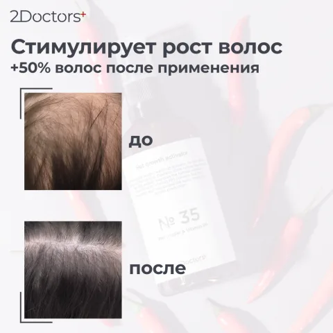 Сыворотка разогревающая для роста волос с перцем и кофеином №35, 2Doctors