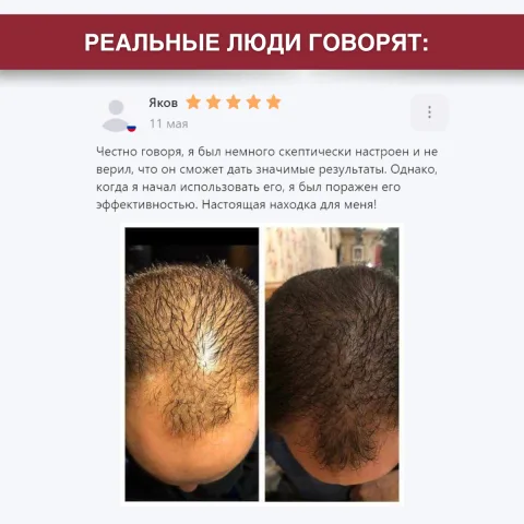 Шампунь для роста и против выпадения волос с перцем и розмарином, Doctor Heiler