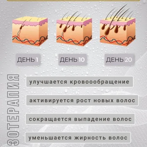 Дермароллер для роста и густоты волос с позолоченными иглами, Wheneva