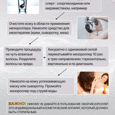 Дермароллер для роста и густоты волос с позолоченными иглами, Wheneva